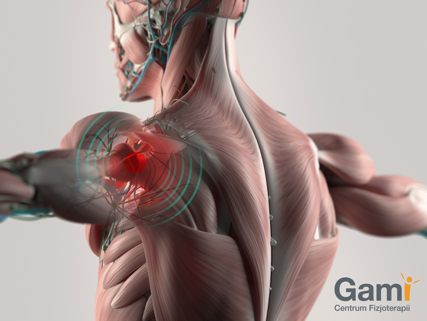 Human anatomy shoulder pain highlighted in red.